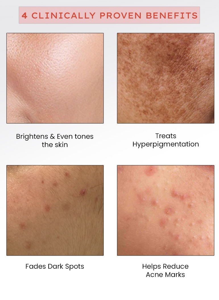 face serum for hydration