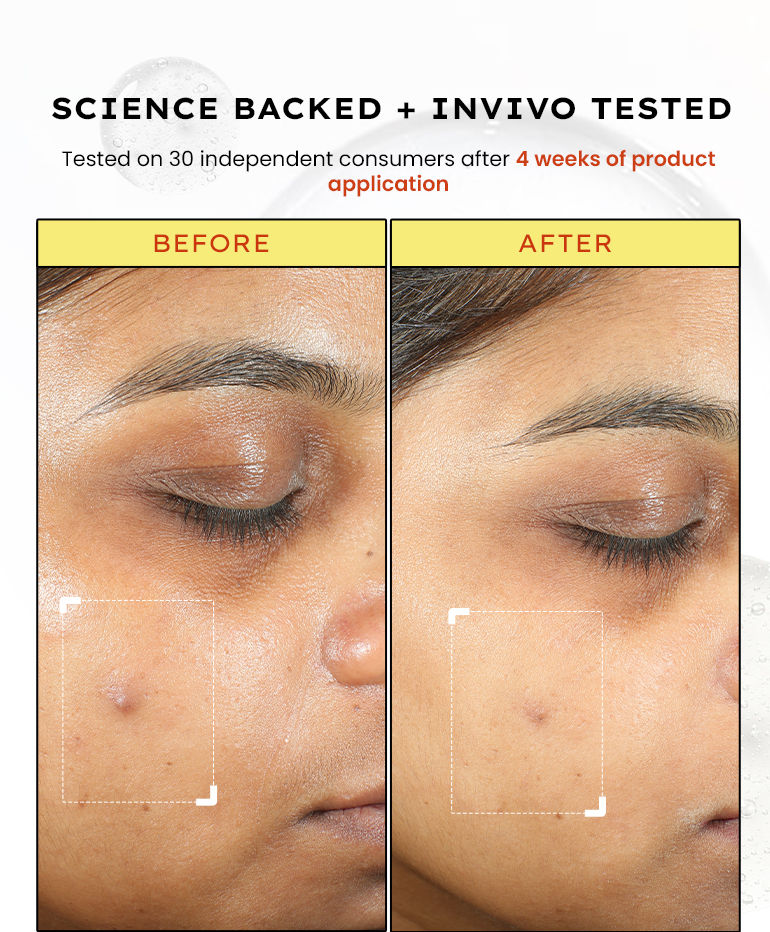 Face Serums