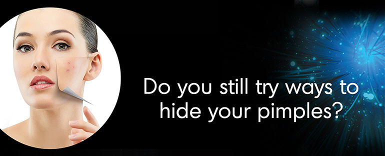 Ponds Oil Control F1-banner