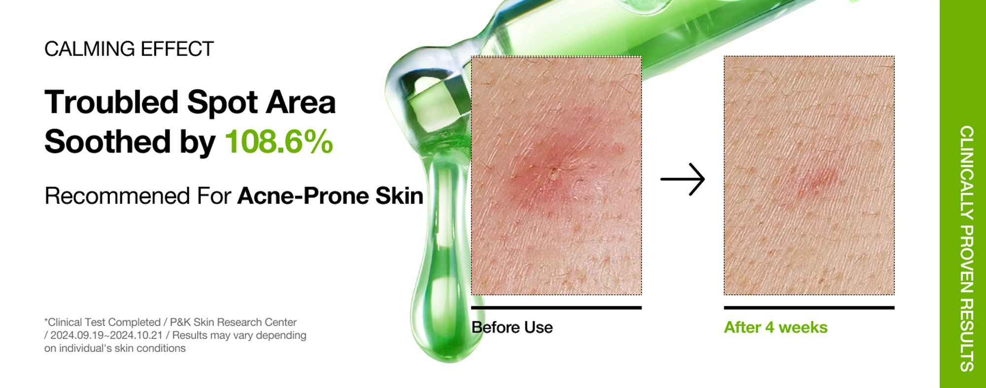 Anua Azelaic Acid 10 Hyaluron Redness Soothing Serum