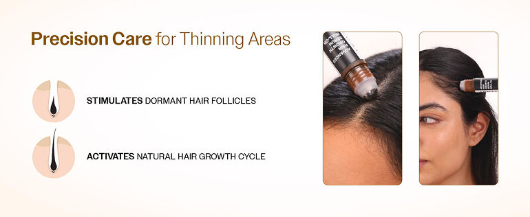 Bare-Anatomy-Advanced-Hair-Growth-Serum-Roll-On-with-Rosemary-and-Redensyl-For-Men-and-Women-25ml