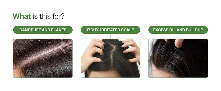 Bare-Anatomy-Nature-x-Science-Dandruff-Control-Scalp-Spray-with-Natural-Neem-and-Lemon-Extracts-200ml