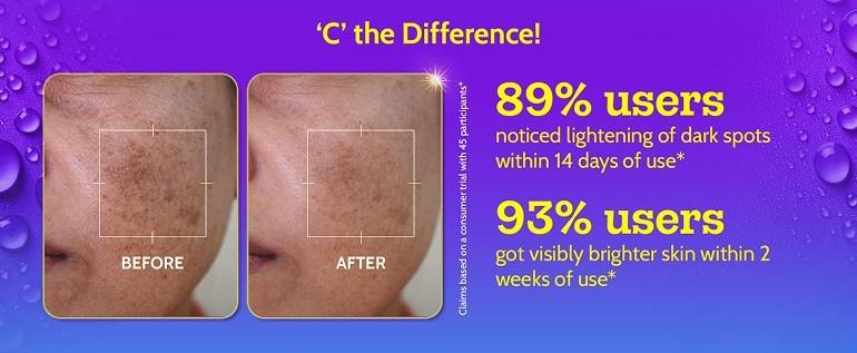 Chemist-At-Play-2per-Salicylic-Acid-Face-Serum-Treats-Active-Acne-Controls-Excess-Oil