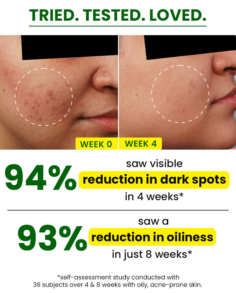 Cica (Centella Asiatica), Niacinamide (Vitamin B3), Anti Acne