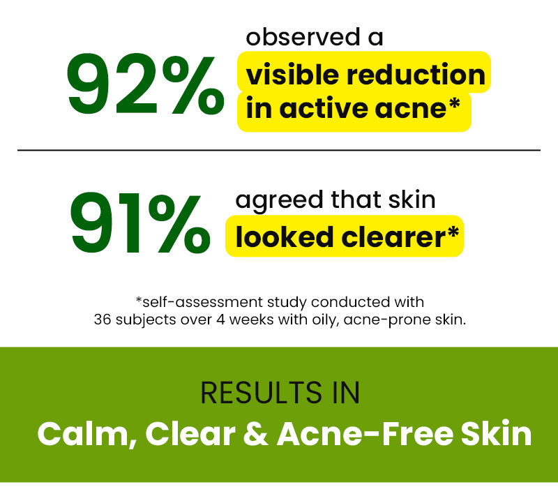 Active Acne treatment, Blackhead treatment, Unclogs Pores