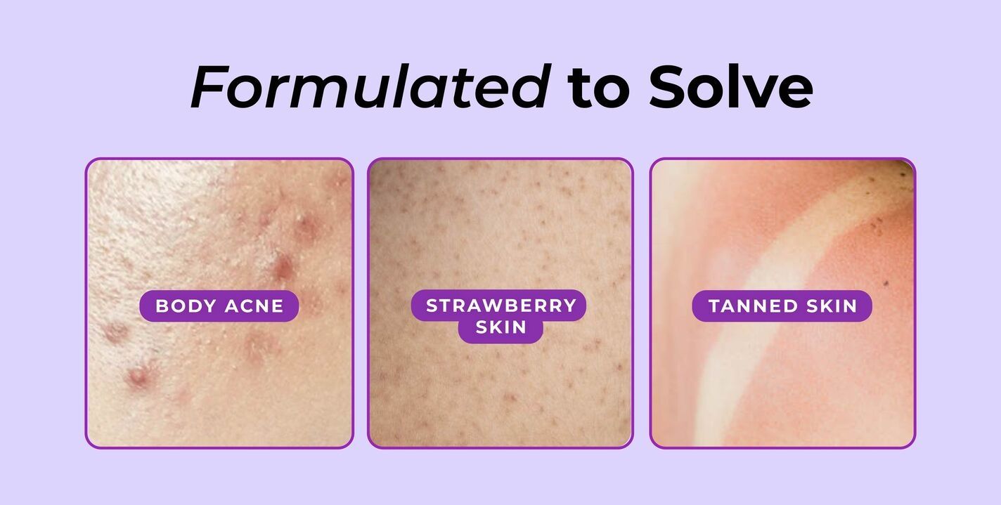 Vitamin C Serum for Dull Skin,Vitamin C Serum for Open Pores,Skin Brightening Serum,Glow Boosting Serum,Instant Glow Serum