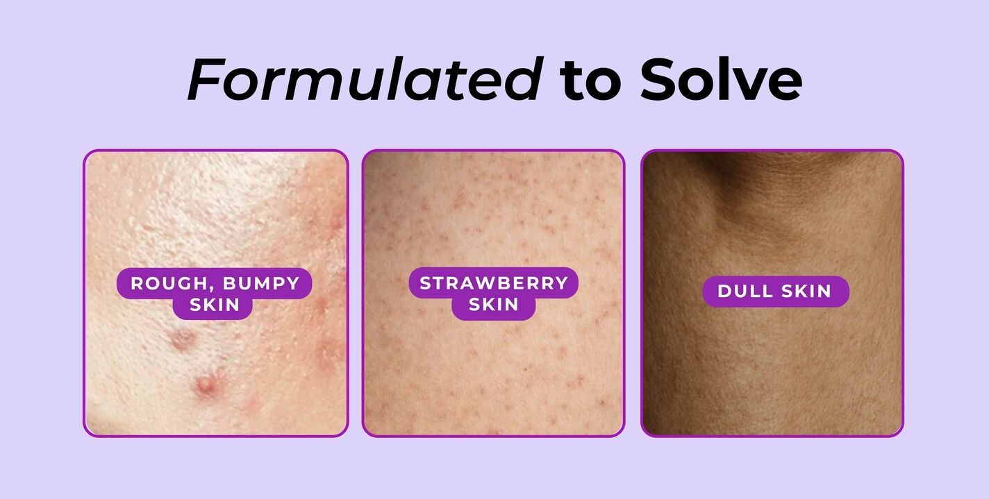 Vitamin C Serum for Dull Skin,Vitamin C Serum for Open Pores,Skin Brightening Serum,Glow Boosting Serum,Instant Glow Serum