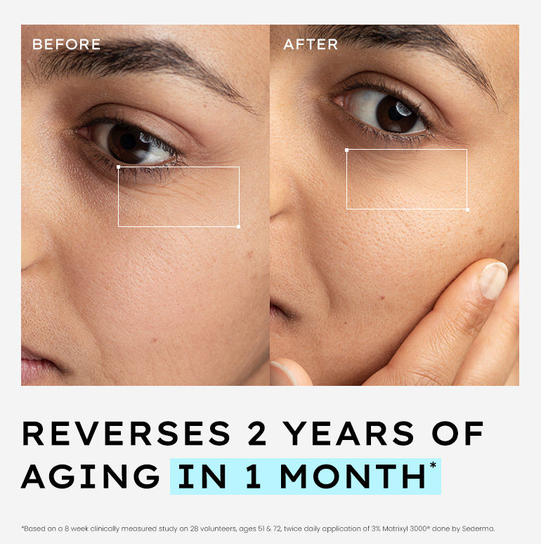 Face Serum for glowing skin