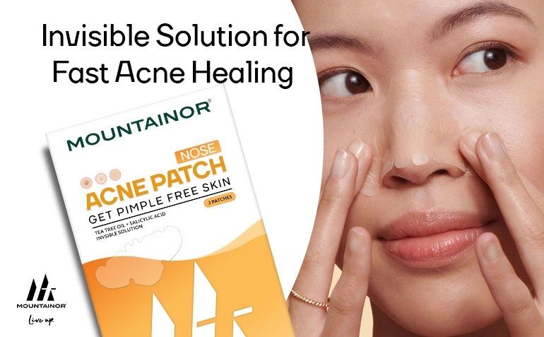 Acne patch for nose