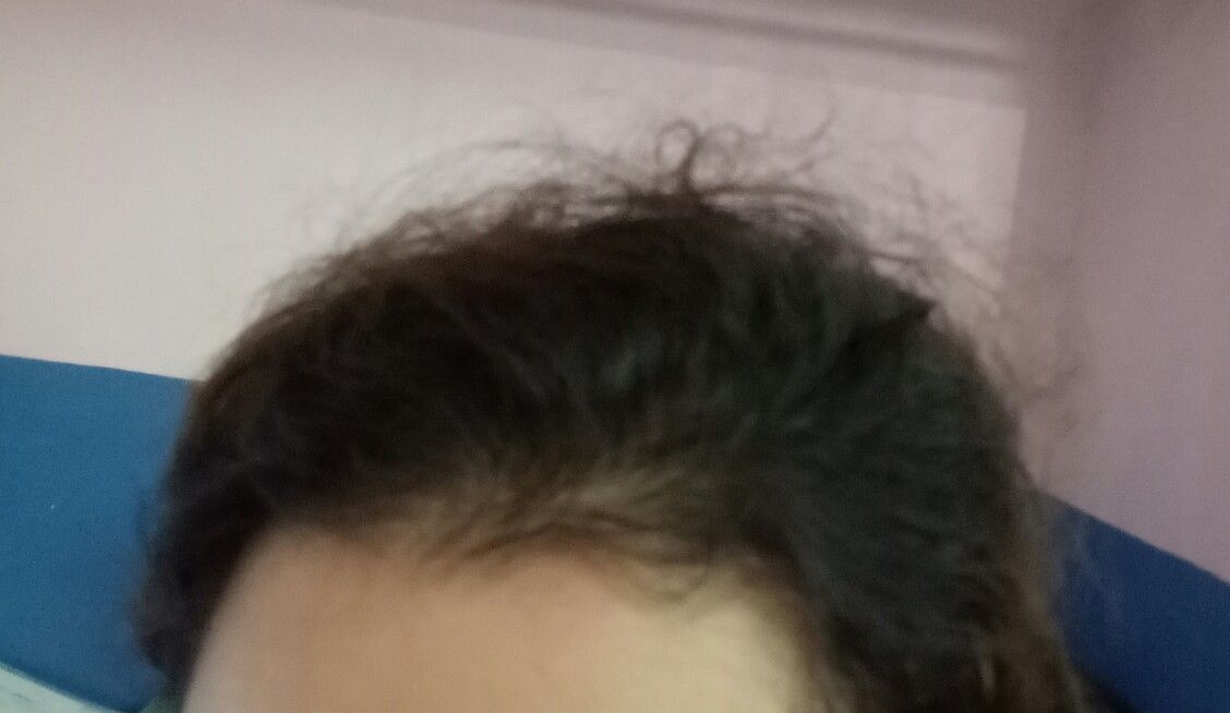My Hair Is Very Rough And Frizzy And Very Fly Away Hairs Plz