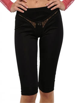Dsquared2 - Black Lace Shorts