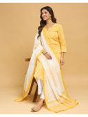 Yellow color option, Sold out, Currently selected