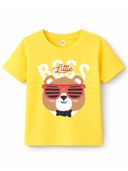 Yellow color option
